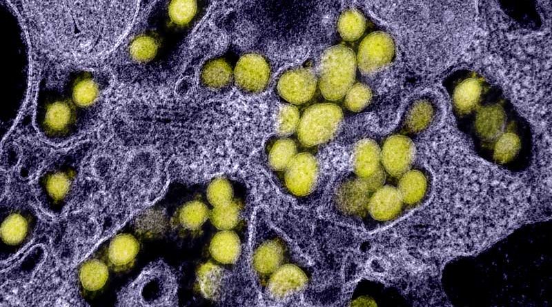 Disease detectives track an invisible virus 1